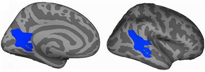 Altered Local Gyrification Index and Corresponding Functional Connectivity in Medication Free Major Depressive Disorder